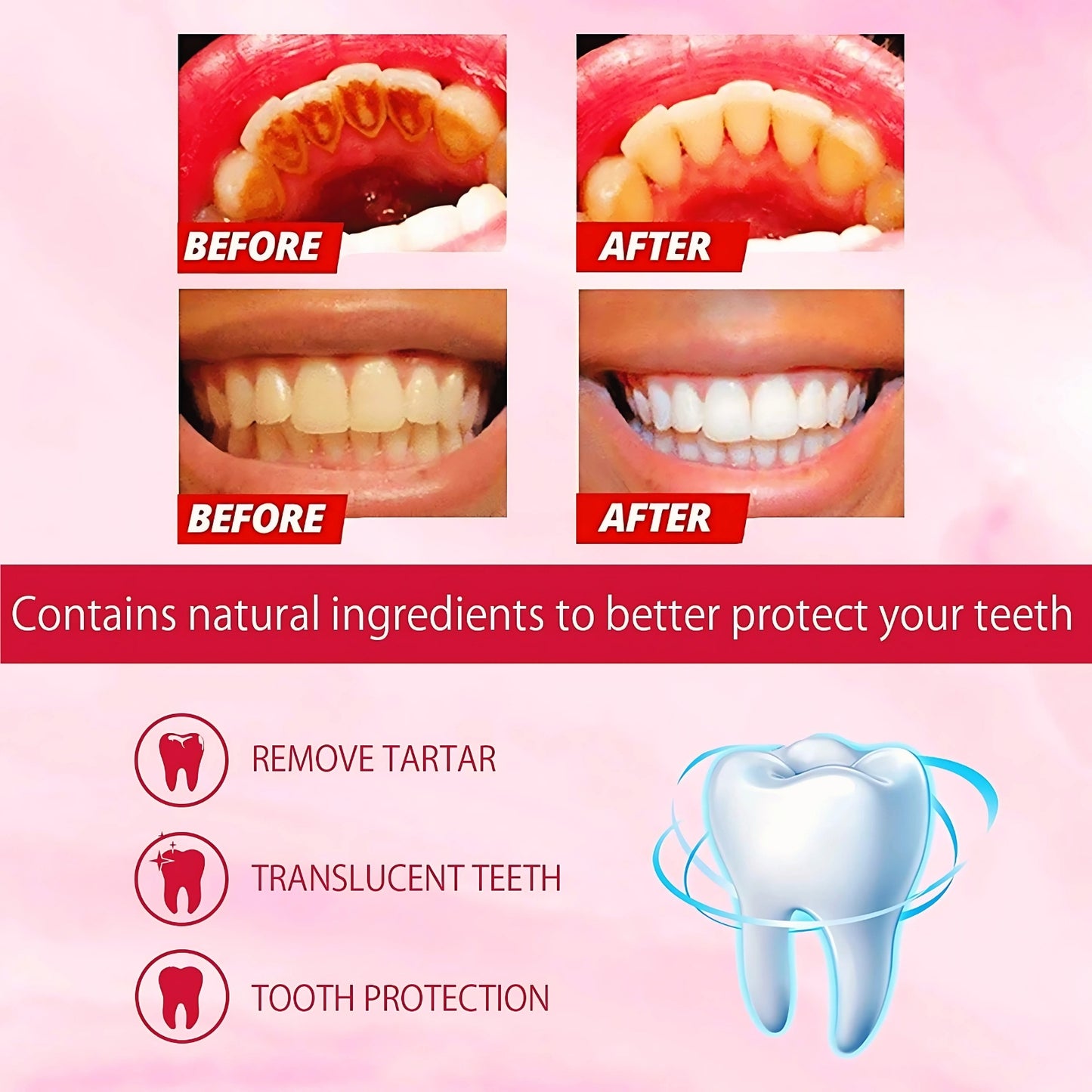 Yayashi Sp-4 Ultra Whitening Toothpaste & Probiotic Stain Remover 120g